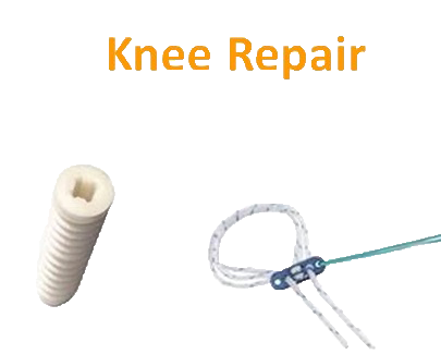 Sports Medicine Knee Repair